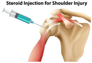 Steroid injections for Shoulder injury